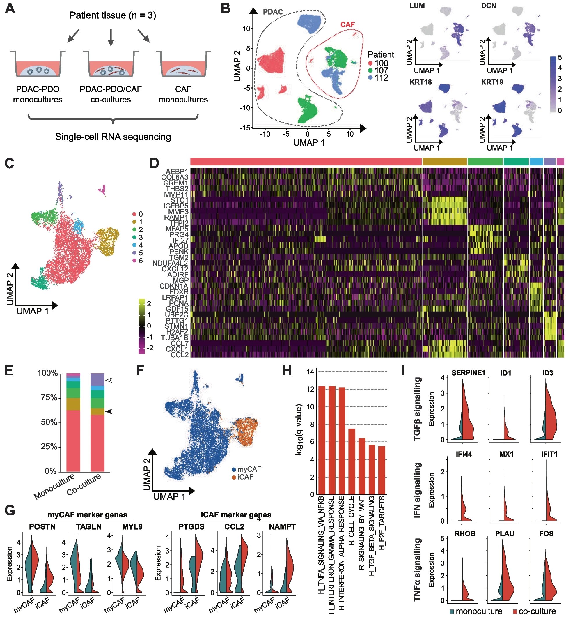 使用三維類器官-成纖維細胞共培養系統對胰腺癌基質介導的化學耐藥性進行患者特異性建模 使用三維類器官-成纖維細胞共培養系統對胰腺癌基質介導的化學耐藥性進行患者特異性建模