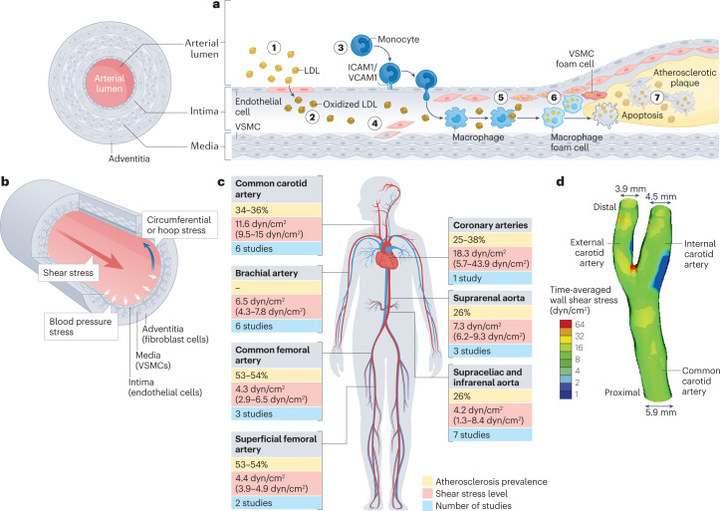 動脈粥樣硬化中血流誘導的內皮細胞重編程