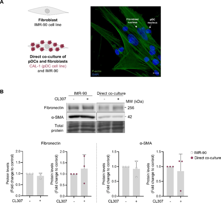 在漿細胞樣樹突狀細胞系中促進內質網應激可驅動成纖維細胞活化