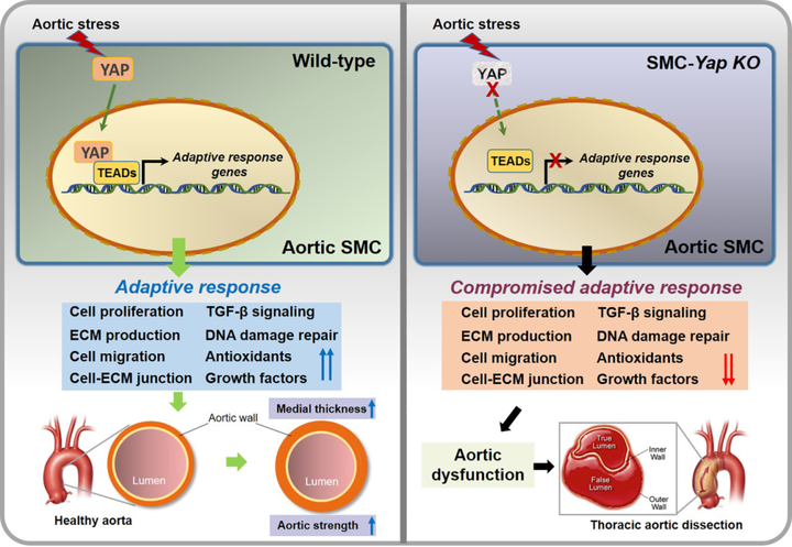 小鼠主動脈應力激活胸主動脈平滑肌細胞中的適應性程序，維持主動脈強度并防止動脈瘤和夾層