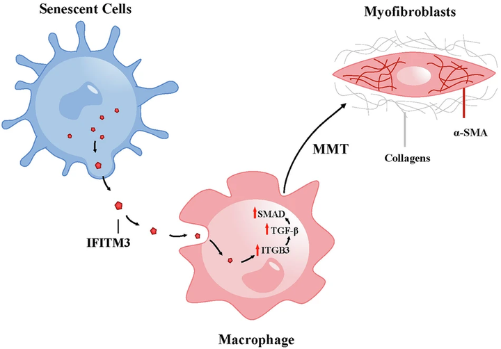 慢性缺血性腎病中細胞衰老促進巨噬細胞向肌成纖維細胞的轉變