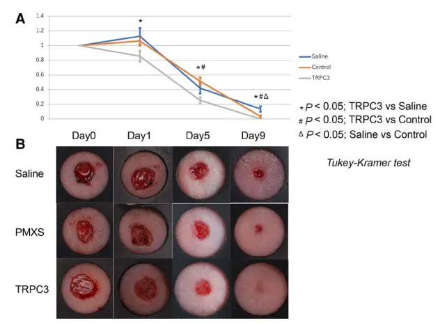 拉伸通過(guò)增強(qiáng)成纖維細(xì)胞中內(nèi)皮素受體B和TRPC3 的表達(dá)來(lái)促進(jìn)傷口收縮